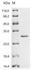 (Tris-Glycine gel) Discontinuous SDS-PAGE (reduced) with 5% enrichment gel and 15% separation gel.