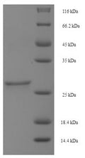 Recombinant Sheep Somatoliberin (GHRH) – Figure 1 of 1