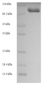 Recombinant Human Glycerol kinase 2 (GK2), partial – Figure 1 of 1