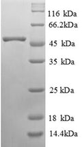 Recombinant Human Alpha-galactosidase A (GLA) – Figure 1 of 1