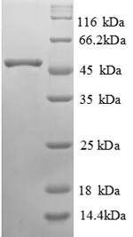 Recombinant Human Alpha-galactosidase A (GLA) – Figure 1 of 1
