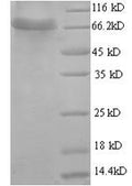 Recombinant Human D-glucuronyl C5-epimerase (GLCE), partial – Figure 1 of 1