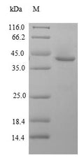 (Tris-Glycine gel) Discontinuous SDS-PAGE (reduced) with 5% enrichment gel and 15% separation gel.