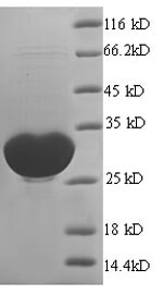 Recombinant Human Glioma pathogenesis-related protein 1 (GLIPR1), partial – Figure 1 of 1