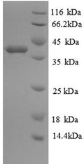 Recombinant Human Glutaredoxin-1 (GLRX) – Figure 1 of 1
