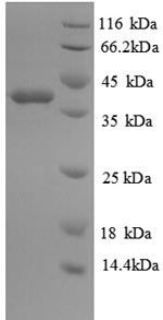 Recombinant Human Glutaredoxin-1 (GLRX) – Figure 1 of 1
