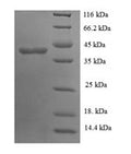 Recombinant Human Glycosyltransferase 8 domain-containing protein 2 (GLT8D2) – Figure 1 of 1