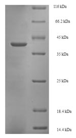 Recombinant Bovine Glycolipid transfer protein (GLTP) – Figure 1 of 1