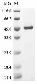 (Tris-Glycine gel) Discontinuous SDS-PAGE (reduced) with 5% enrichment gel and 15% separation gel.