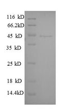 Recombinant Human Guanine nucleotide-binding protein G (i) subunit alpha-3 (GNAI3) – Figure 1 of 1