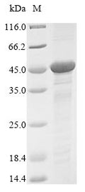 (Tris-Glycine gel) Discontinuous SDS-PAGE (reduced) with 5% enrichment gel and 15% separation gel.