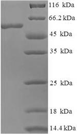 Recombinant Human Guanine nucleotide-binding protein subunit beta-5 (GNB5) – Figure 1 of 1