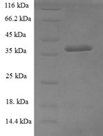 Recombinant Human Glucosamine-6-phosphate isomerase 1 (GNPDA1) – Figure 1 of 1