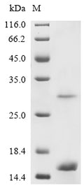 (Tris-Glycine gel) Discontinuous SDS-PAGE (reduced) with 5% enrichment gel and 15% separation gel.