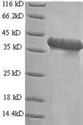 Recombinant Human Progonadoliberin-2 (GNRH2) – Figure 1 of 1