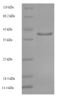Recombinant Human Golgi SNAP receptor complex member 2 (GOSR2), partial – Figure 1 of 1