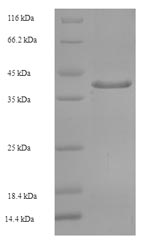 Recombinant Human Golgi SNAP receptor complex member 2 (GOSR2), partial – Figure 1 of 1