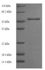 Recombinant Human Platelet glycoprotein Ib alpha chain (GP1BA), partial – Figure 1 of 1