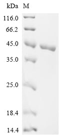 (Tris-Glycine gel) Discontinuous SDS-PAGE (reduced) with 5% enrichment gel and 15% separation gel.