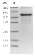 Recombinant Human Alanine aminotransferase 1 (GPT) – Figure 1 of 1