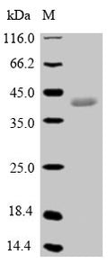 (Tris-Glycine gel) Discontinuous SDS-PAGE (reduced) with 5% enrichment gel and 15% separation gel.