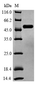 (Tris-Glycine gel) Discontinuous SDS-PAGE (reduced) with 5% enrichment gel and 15% separation gel.