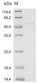 (Tris-Glycine gel) Discontinuous SDS-PAGE (reduced) with 5% enrichment gel and 15% separation gel.