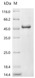 (Tris-Glycine gel) Discontinuous SDS-PAGE (reduced) with 5% enrichment gel and 15% separation gel.