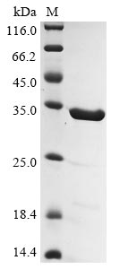 (Tris-Glycine gel) Discontinuous SDS-PAGE (reduced) with 5% enrichment gel and 15% separation gel.
