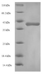 Recombinant Rat Glutathione S-transferase alpha-1 (Gsta1) – Figure 1 of 1