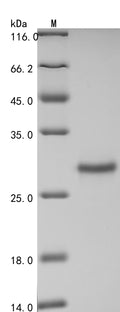 (Tris-Glycine gel) Discontinuous SDS-PAGE (reduced) with 5% enrichment gel and 15% separation gel.