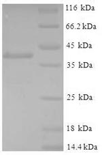 Recombinant Mouse Glutathione S-transferase P 1 (Gstp1) – Figure 1 of 1