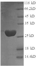 Recombinant Rat Glutathione S-transferase P (Gstp1) – Figure 1 of 1
