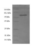 Recombinant Human Transcription initiation factor IIB (GTF2B) – Figure 1 of 1