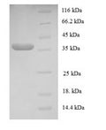 Recombinant Human Transcription initiation factor IIE subunit beta (GTF2E2) – Figure 1 of 1