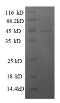Recombinant Human General transcription factor IIF subunit 2 (GTF2F2) – Figure 1 of 1