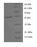 Recombinant Human General transcription factor IIH subunit 5 (GTF2H5) – Figure 1 of 1