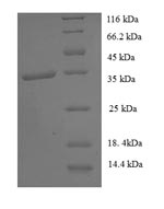 Recombinant Human General transcription factor IIH subunit 5 (GTF2H5) – Figure 1 of 1