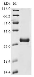(Tris-Glycine gel) Discontinuous SDS-PAGE (reduced) with 5% enrichment gel and 15% separation gel.