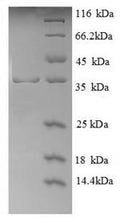 Recombinant Human Glycophorin-A (GYPA), partial – Figure 1 of 1