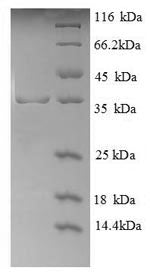 Recombinant Human Glycophorin-A (GYPA), partial – Figure 1 of 1