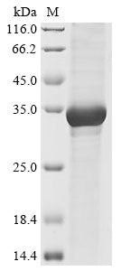 (Tris-Glycine gel) Discontinuous SDS-PAGE (reduced) with 5% enrichment gel and 15% separation gel.