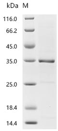 (Tris-Glycine gel) Discontinuous SDS-PAGE (reduced) with 5% enrichment gel and 15% separation gel.