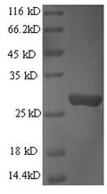 Recombinant Human Granzyme B (GZMB) – Figure 1 of 1