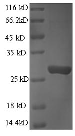 Recombinant Human Granzyme B (GZMB) – Figure 1 of 1