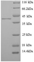 Recombinant Human Histone H2A.J (H2AFJ) – Figure 1 of 1
