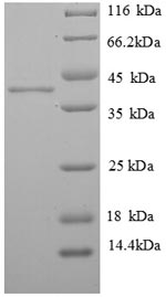 Recombinant Human Histone H2A.J (H2AFJ) – Figure 1 of 1