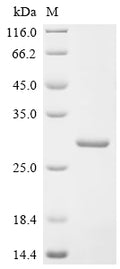 (Tris-Glycine gel) Discontinuous SDS-PAGE (reduced) with 5% enrichment gel and 15% separation gel.