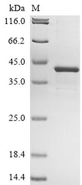 (Tris-Glycine gel) Discontinuous SDS-PAGE (reduced) with 5% enrichment gel and 15% separation gel.
