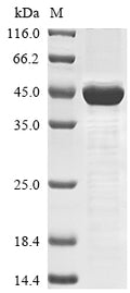 (Tris-Glycine gel) Discontinuous SDS-PAGE (reduced) with 5% enrichment gel and 15% separation gel.